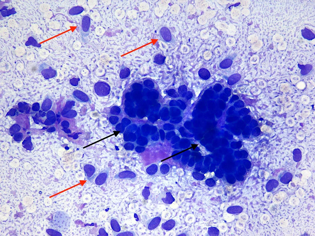 flea allergy dermatitis diagnosis