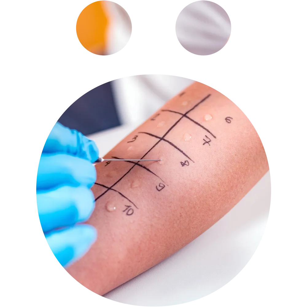 veterinary allergy testing methods